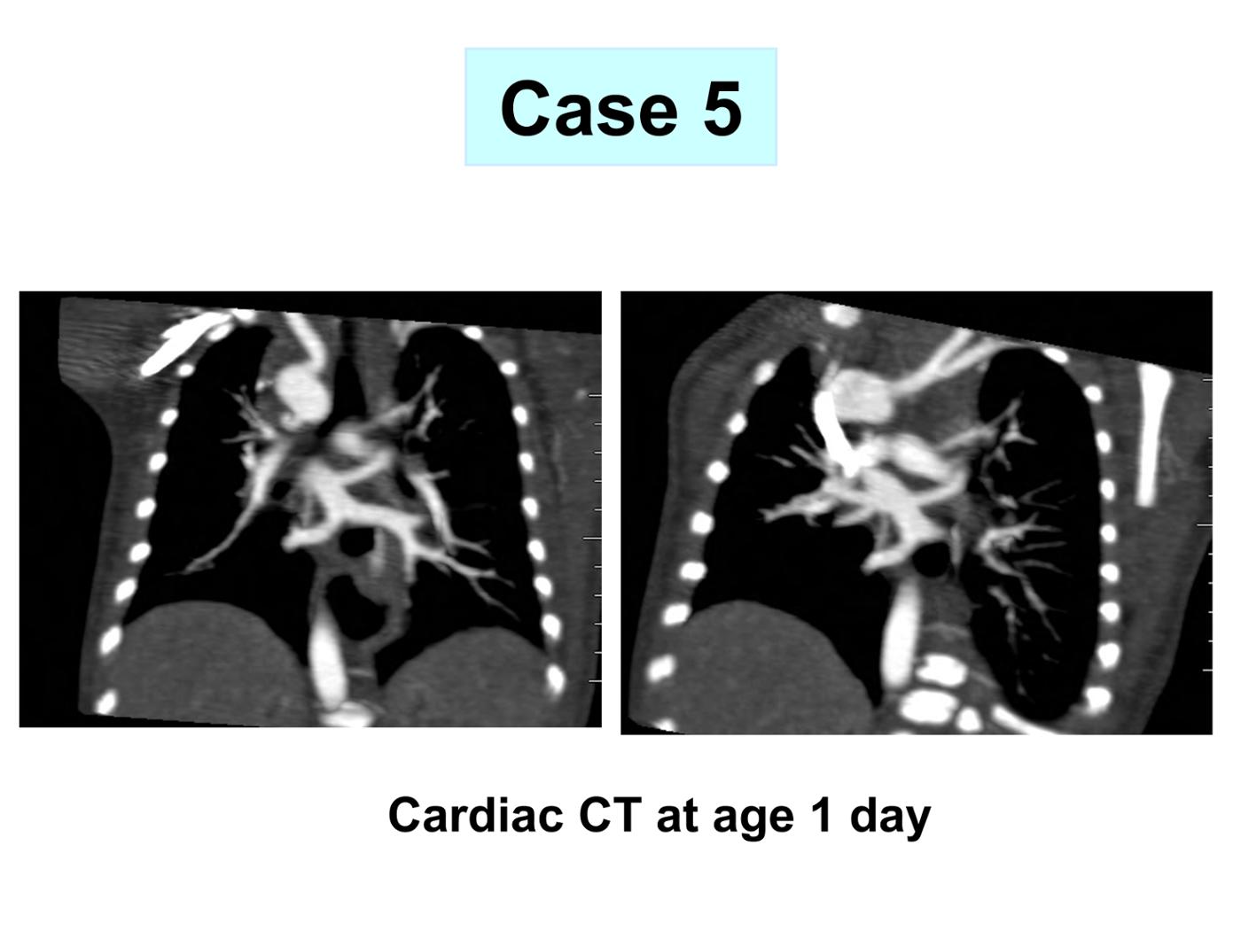 2025 Pediatric Heart Forum Presentation 347페이지