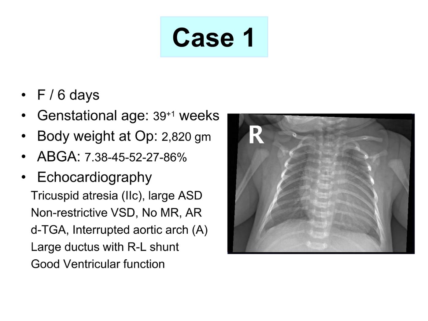2025 Pediatric Heart Forum Presentation 322페이지