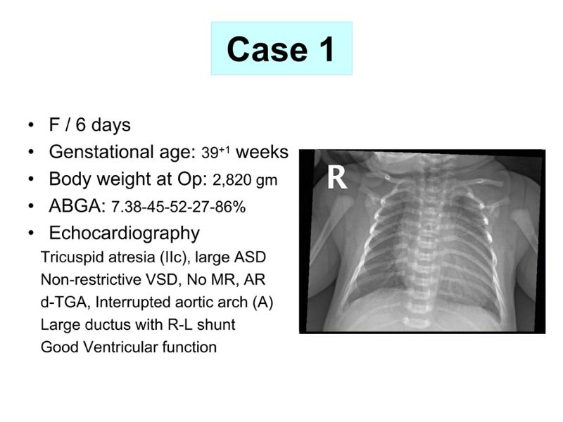2025 Pediatric Heart Forum Presentation 322페이지