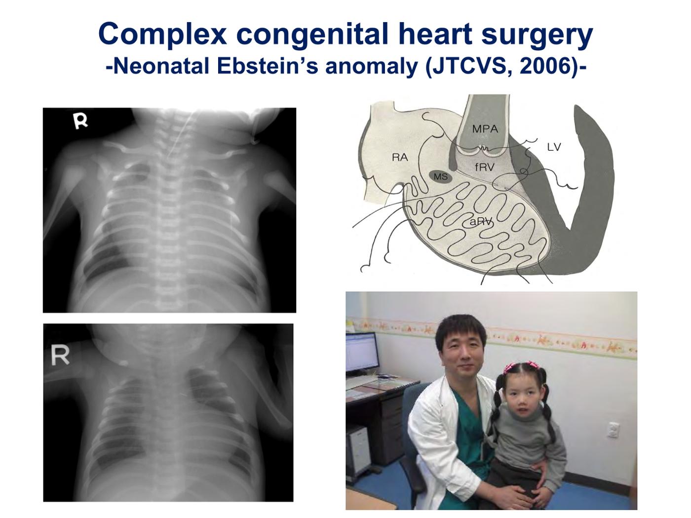 2025 Pediatric Heart Forum Presentation 258페이지