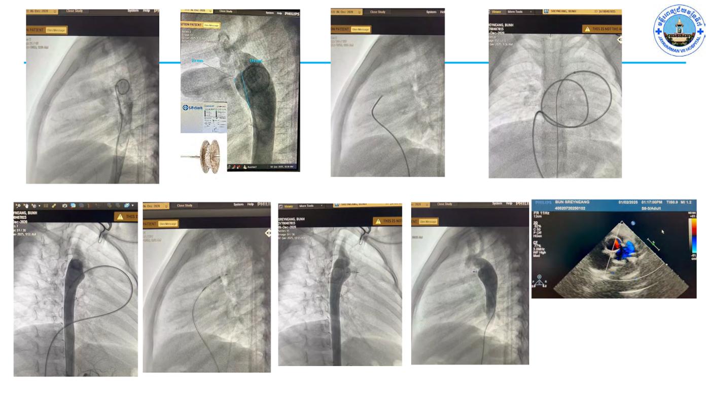 2025 Pediatric Heart Forum Presentation 67페이지