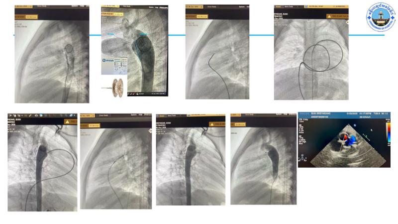 2025 Pediatric Heart Forum Presentation 67페이지