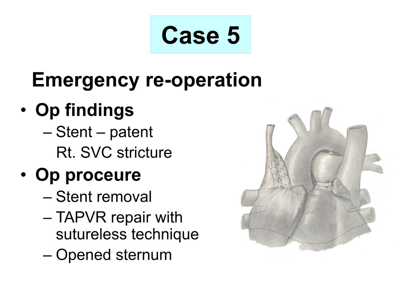 2025 Pediatric Heart Forum Presentation 359페이지