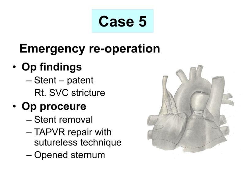 2025 Pediatric Heart Forum Presentation 359페이지