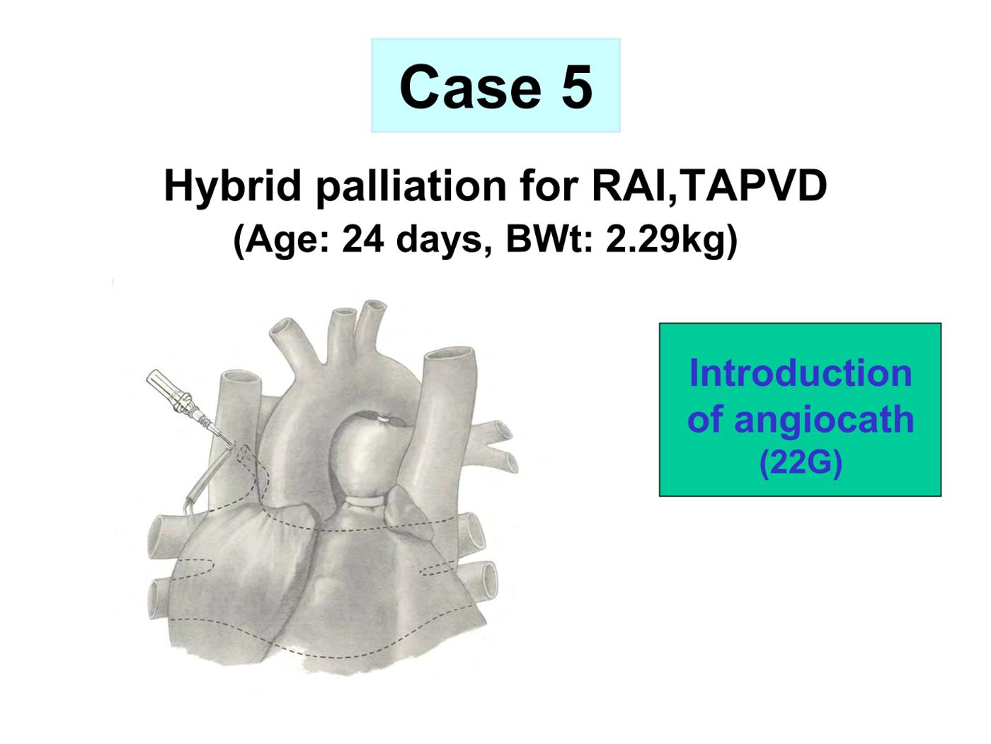 2025 Pediatric Heart Forum Presentation 351페이지