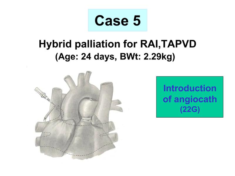 2025 Pediatric Heart Forum Presentation 351페이지