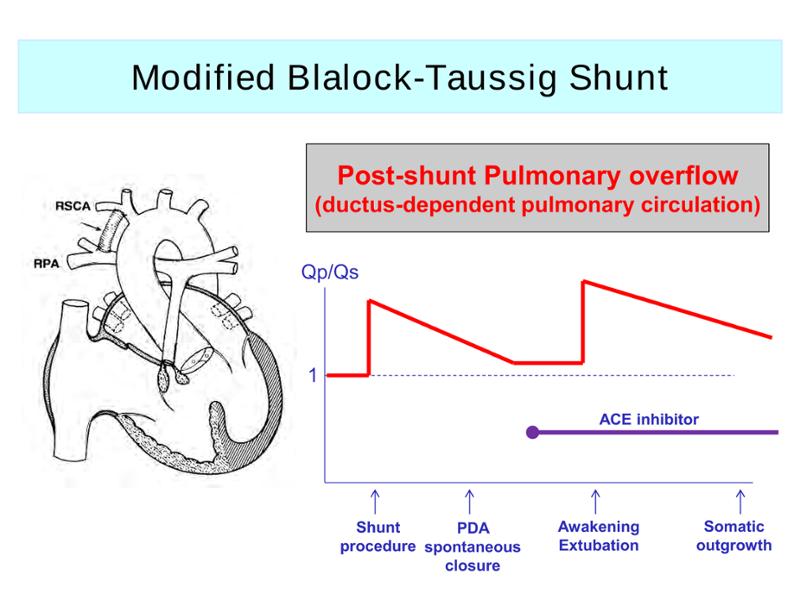 2025 Pediatric Heart Forum Presentation 285페이지