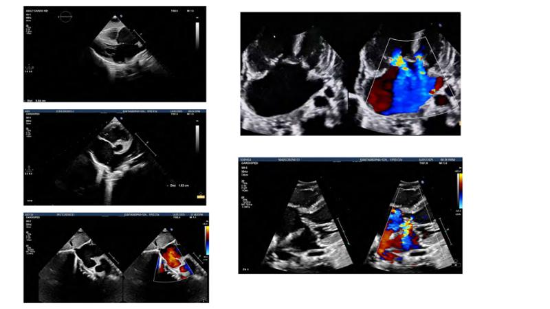 2025 Pediatric Heart Forum Presentation 154페이지
