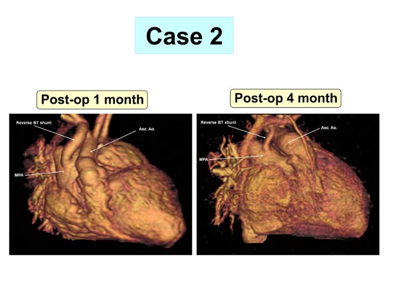2025 Pediatric Heart Forum Presentation 330페이지