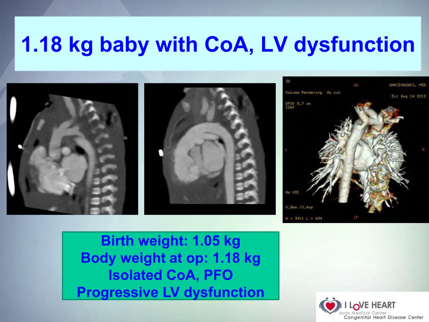 2025 Pediatric Heart Forum Presentation 268페이지