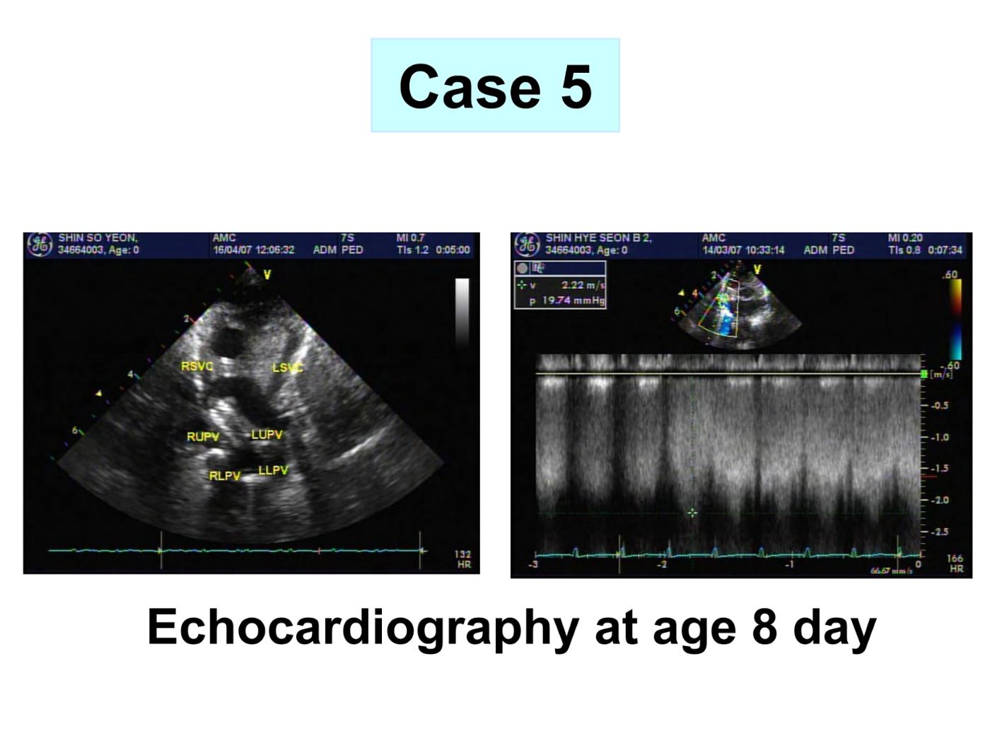 2025 Pediatric Heart Forum Presentation 349페이지