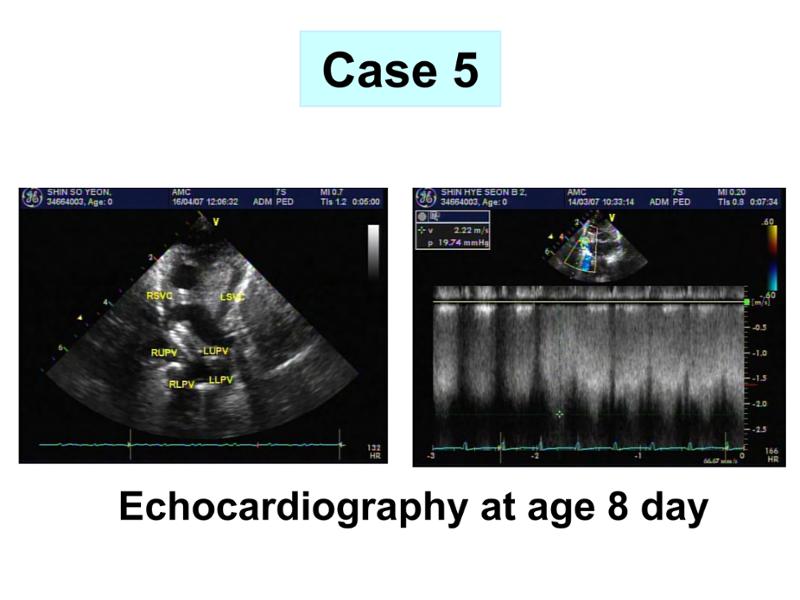 2025 Pediatric Heart Forum Presentation 349페이지
