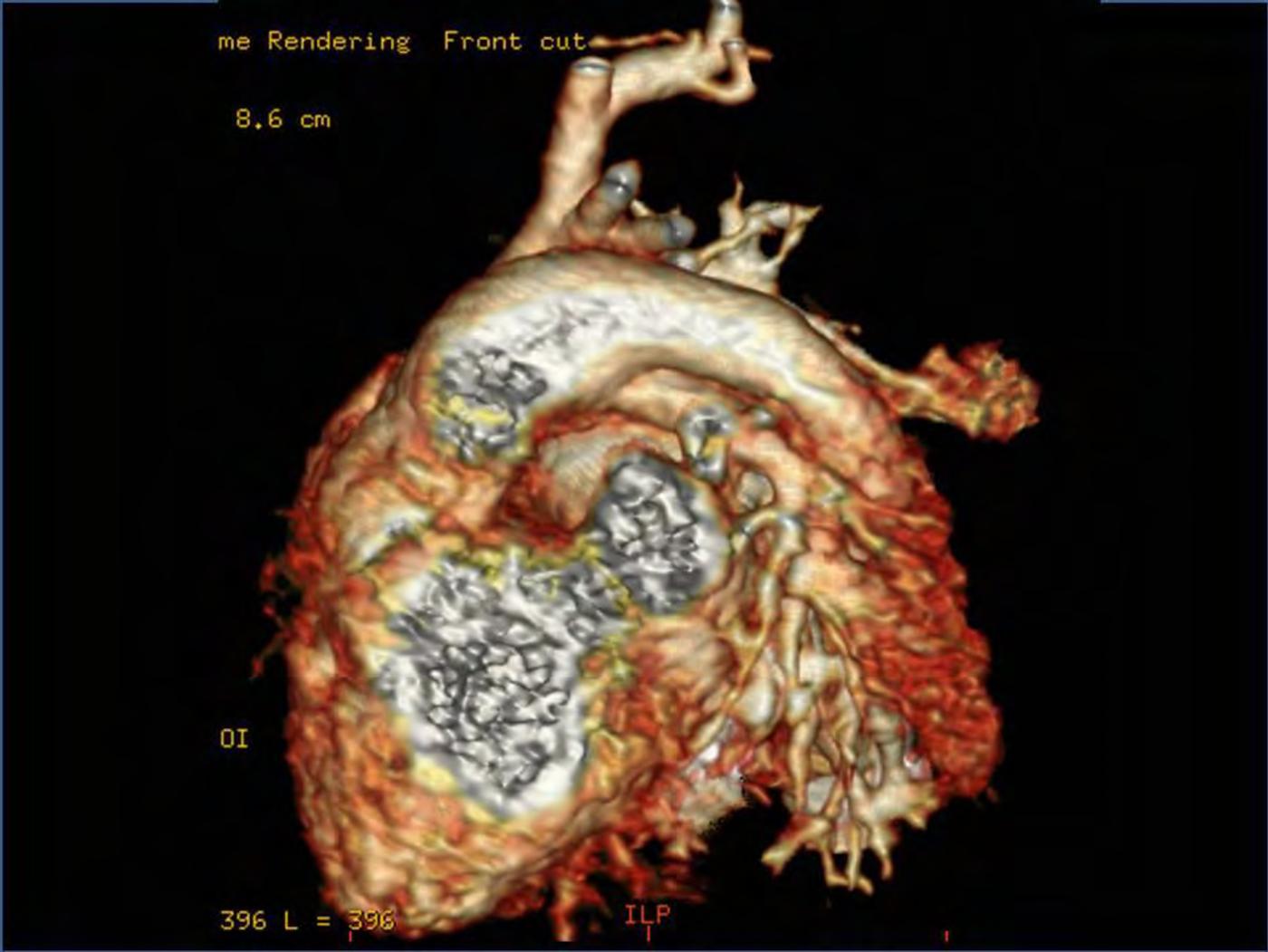2025 Pediatric Heart Forum Presentation 325페이지