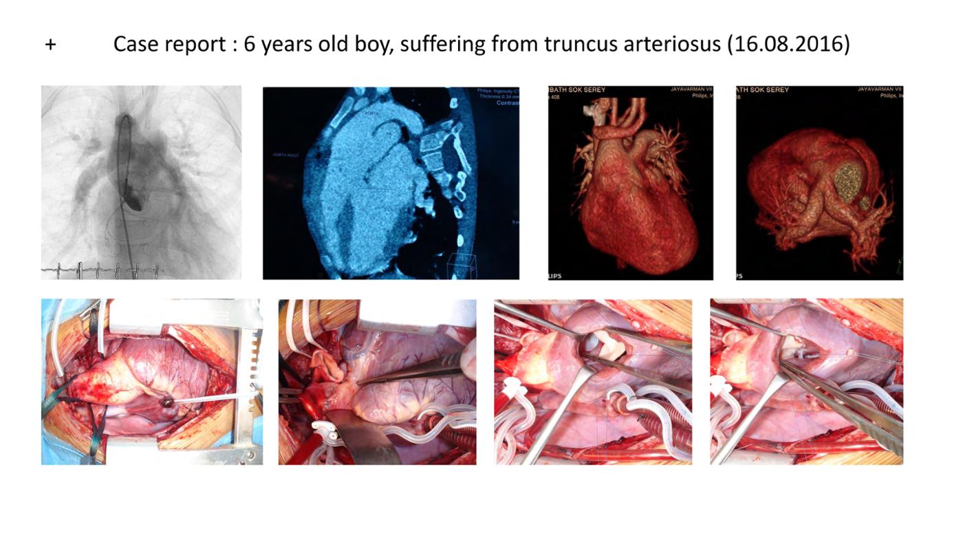 2025 Pediatric Heart Forum Presentation 381페이지