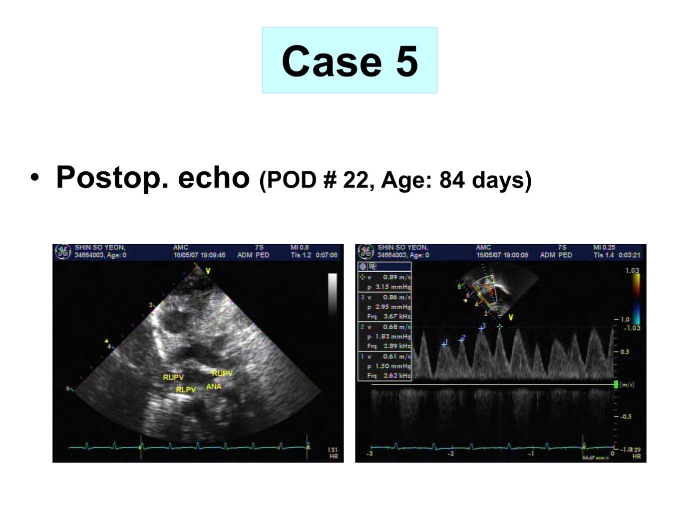 2025 Pediatric Heart Forum Presentation 360페이지