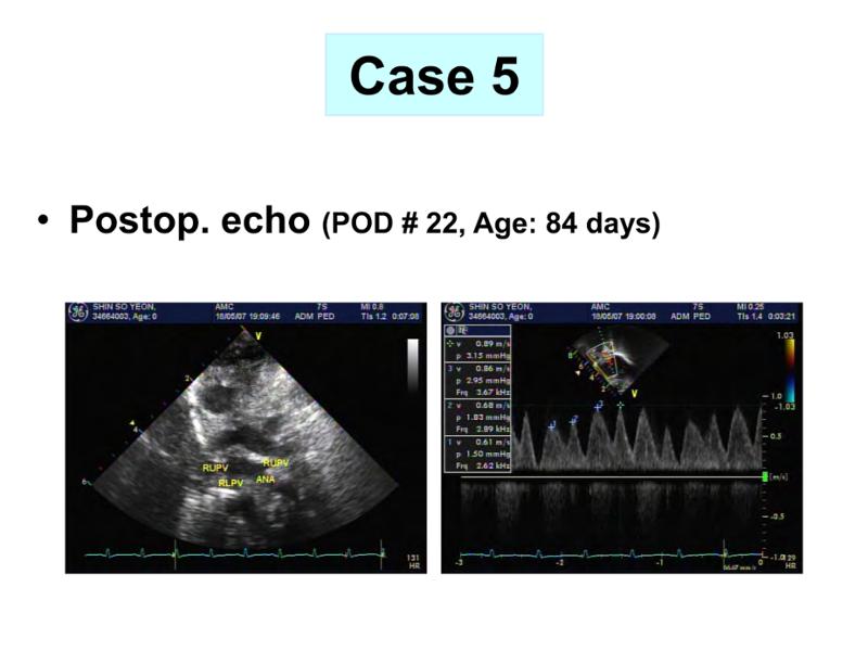 2025 Pediatric Heart Forum Presentation 360페이지