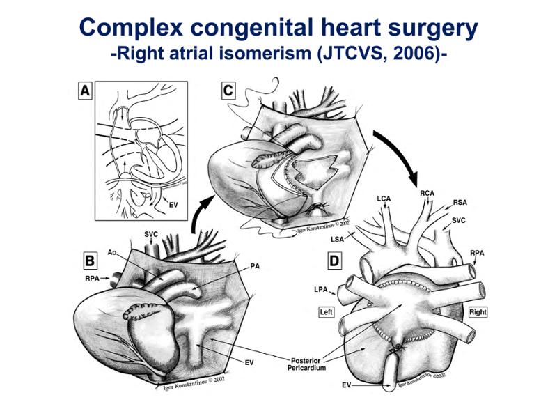2025 Pediatric Heart Forum Presentation 255페이지