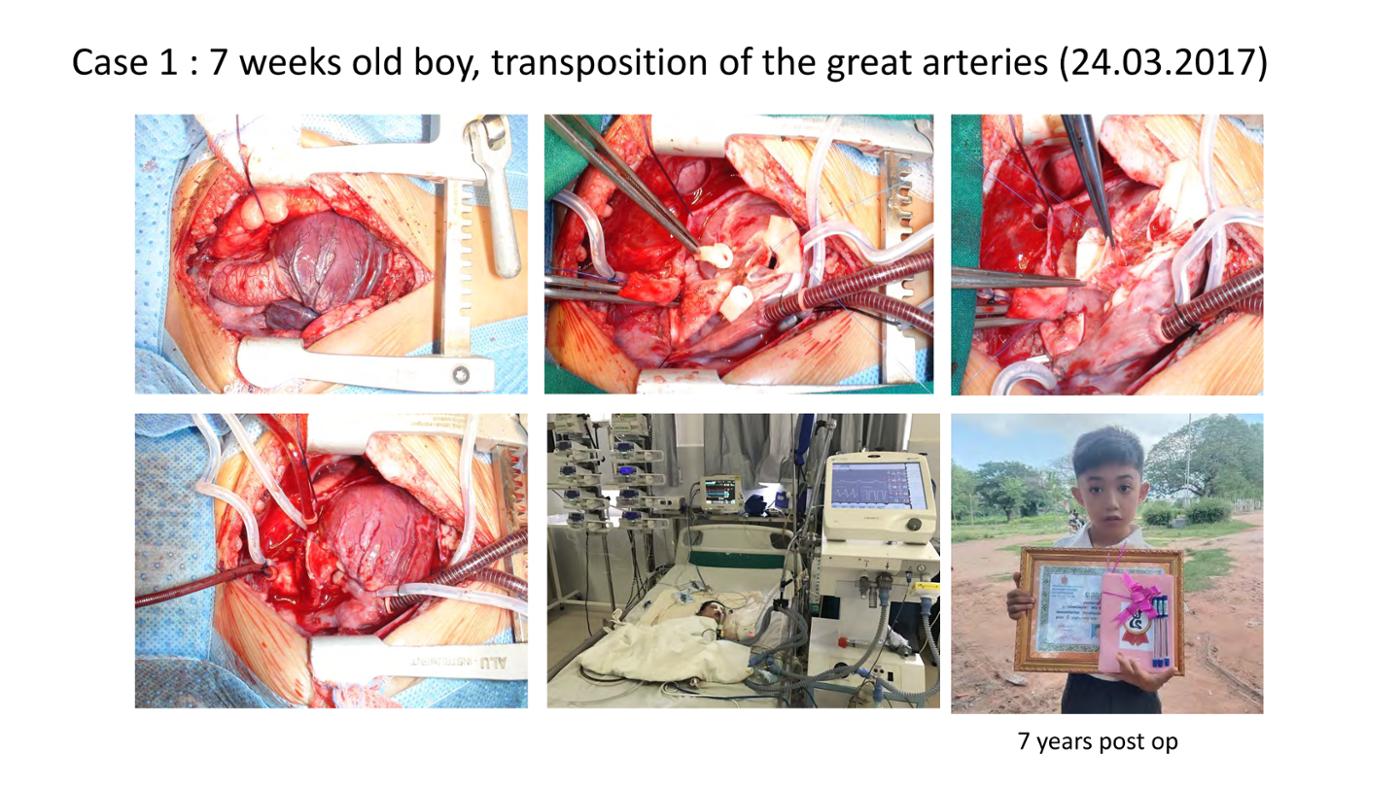 2025 Pediatric Heart Forum Presentation 391페이지