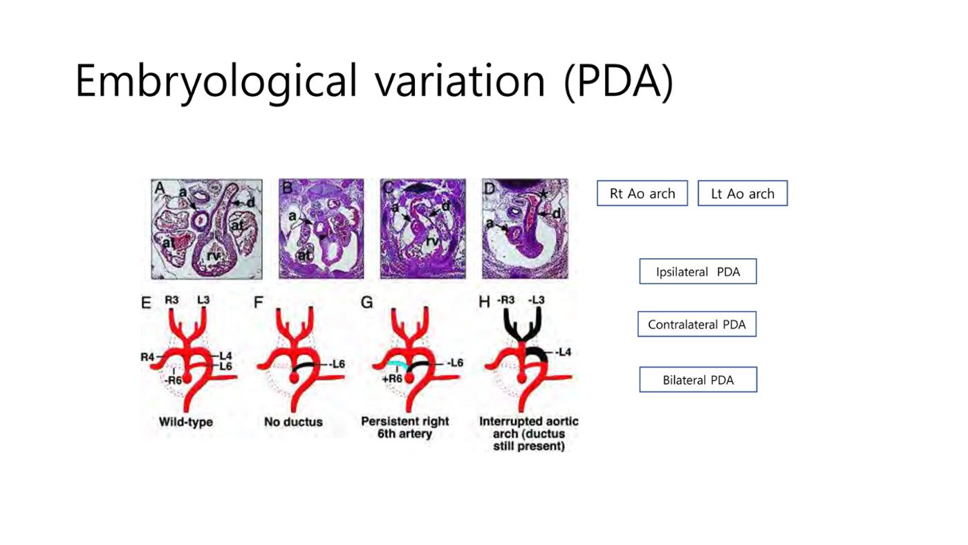 2025 Pediatric Heart Forum Presentation 4페이지