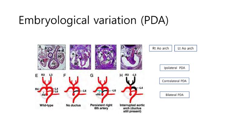 2025 Pediatric Heart Forum Presentation 4페이지