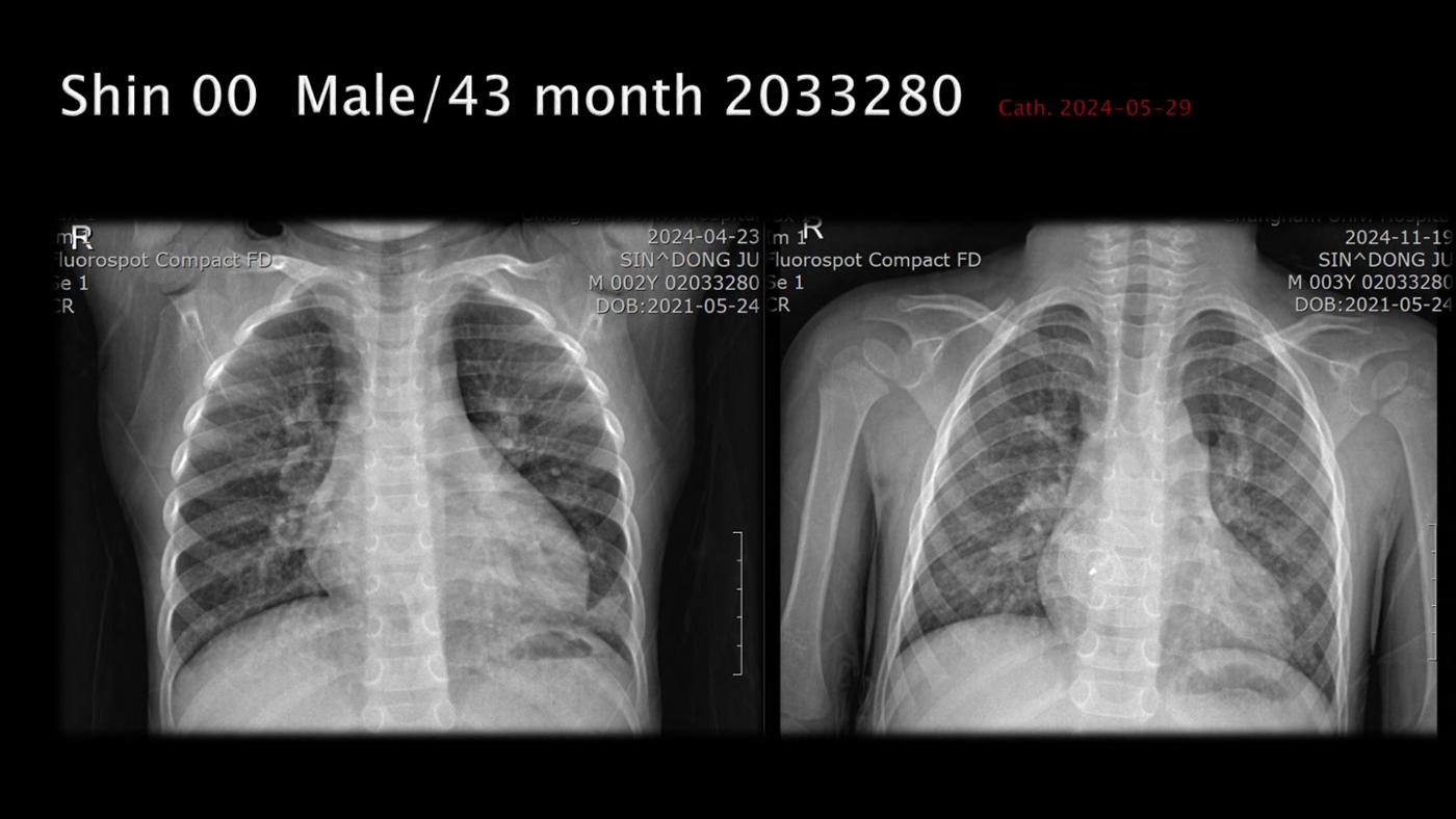 2025 Pediatric Heart Forum Presentation 125페이지