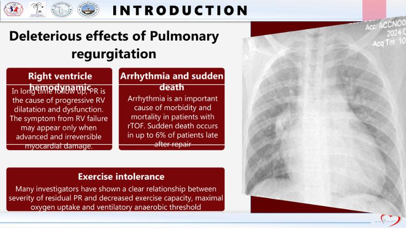 2025 Pediatric Heart Forum Presentation 237페이지