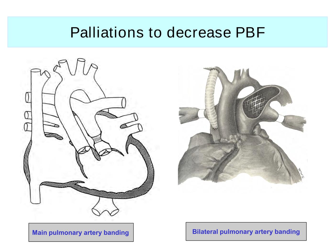 2025 Pediatric Heart Forum Presentation 286페이지