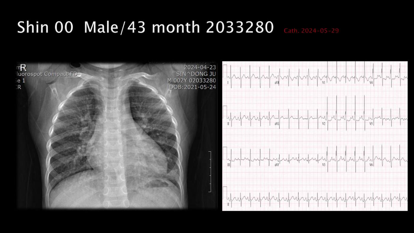 2025 Pediatric Heart Forum Presentation 124페이지
