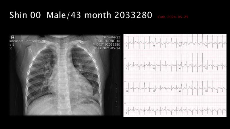 2025 Pediatric Heart Forum Presentation 124페이지