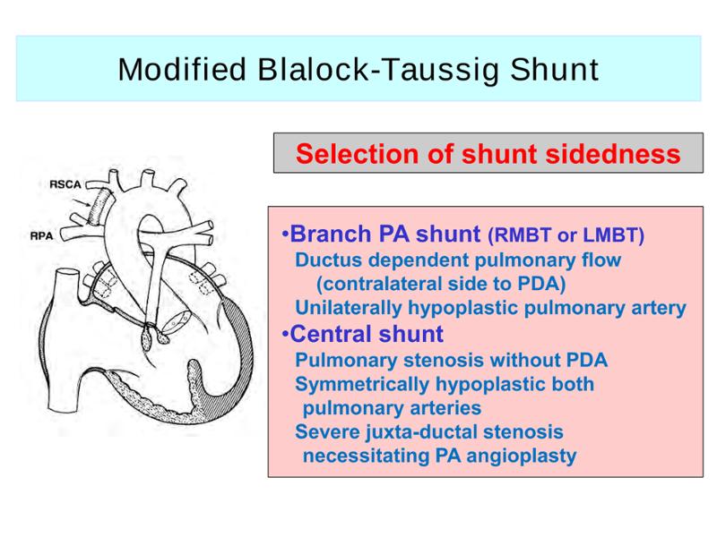 2025 Pediatric Heart Forum Presentation 283페이지