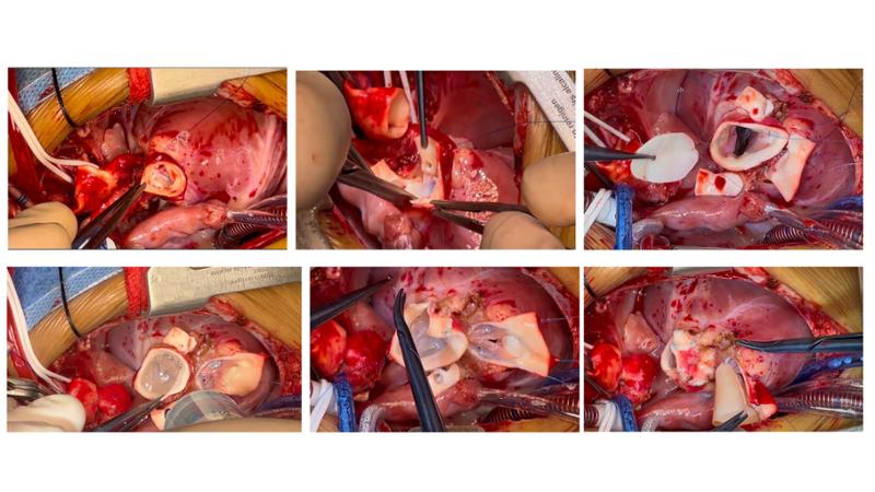 2025 Pediatric Heart Forum Presentation 393페이지