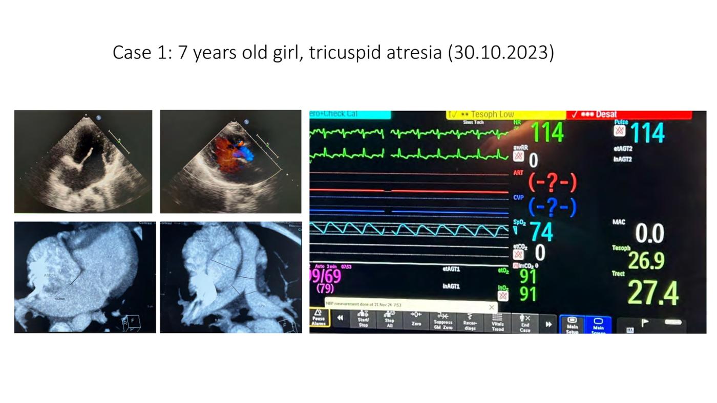 2025 Pediatric Heart Forum Presentation 386페이지
