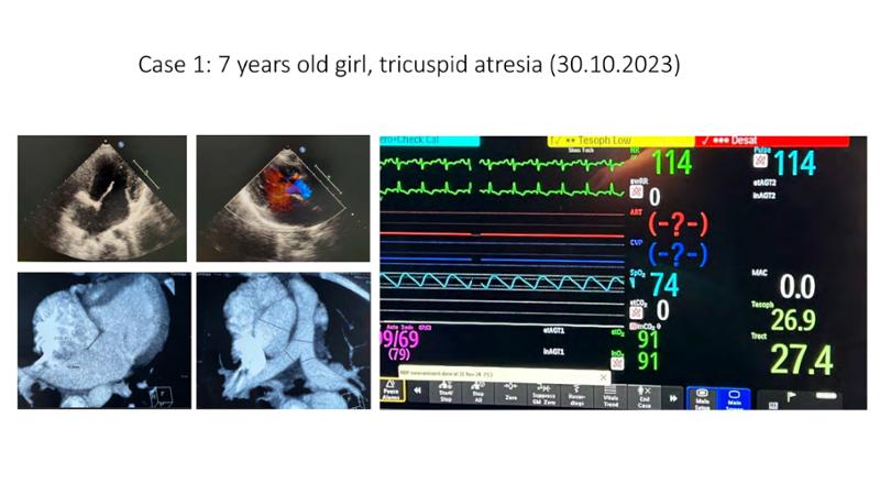 2025 Pediatric Heart Forum Presentation 386페이지