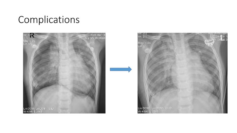 2025 Pediatric Heart Forum Presentation 161페이지