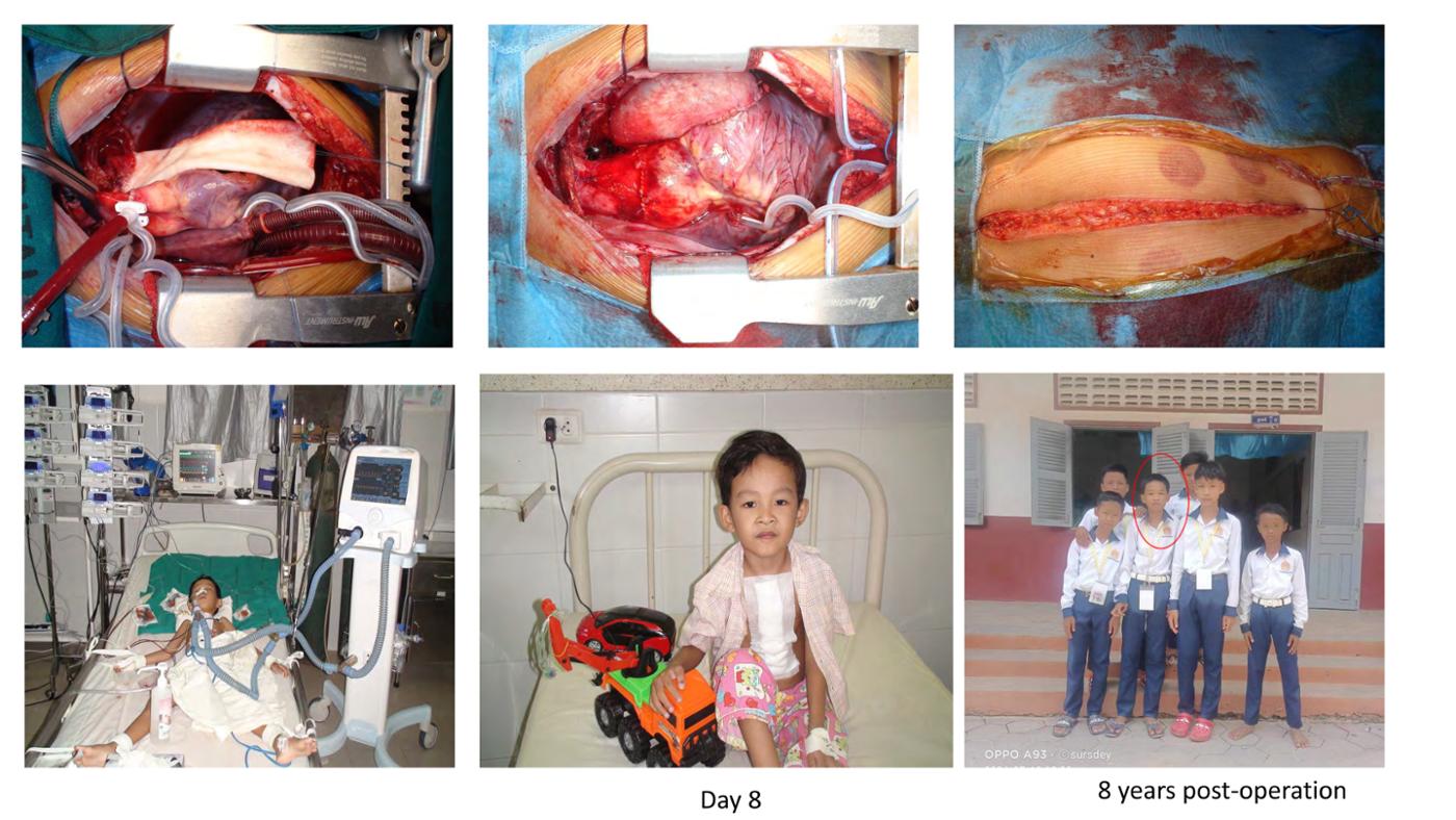 2025 Pediatric Heart Forum Presentation 382페이지