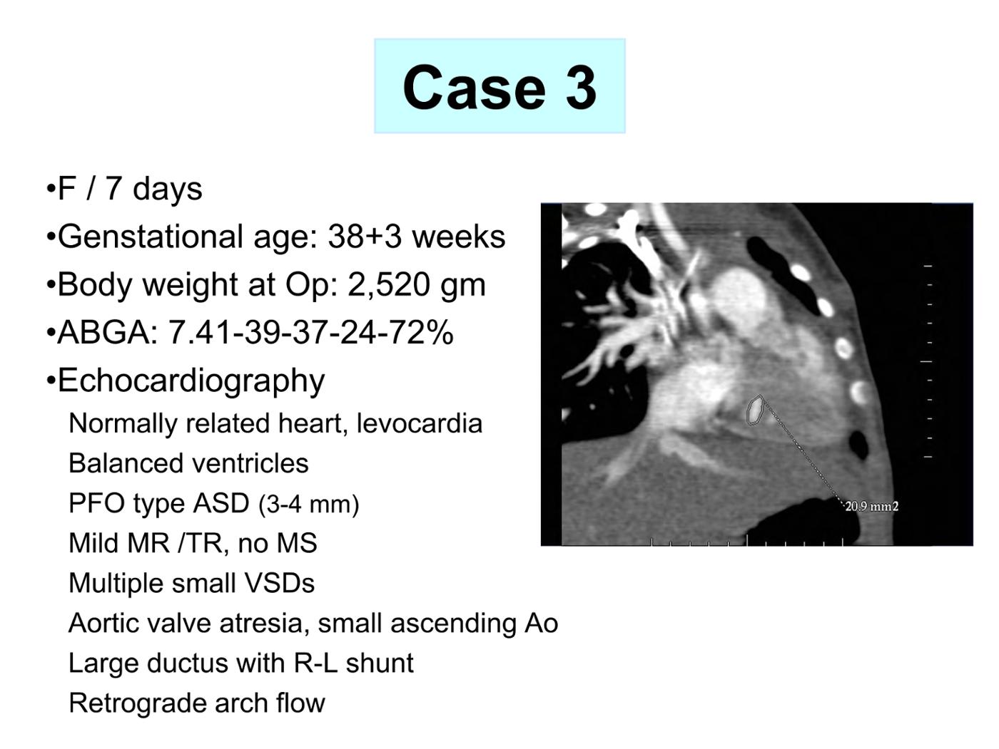 2025 Pediatric Heart Forum Presentation 334페이지