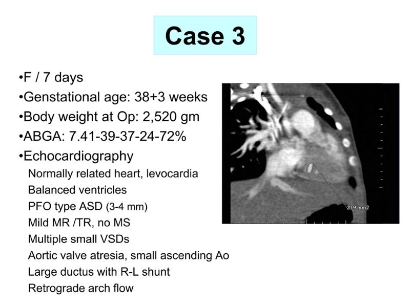 2025 Pediatric Heart Forum Presentation 334페이지