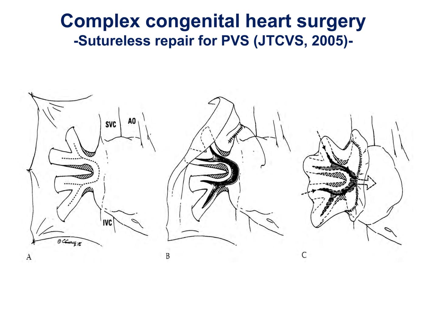 2025 Pediatric Heart Forum Presentation 252페이지