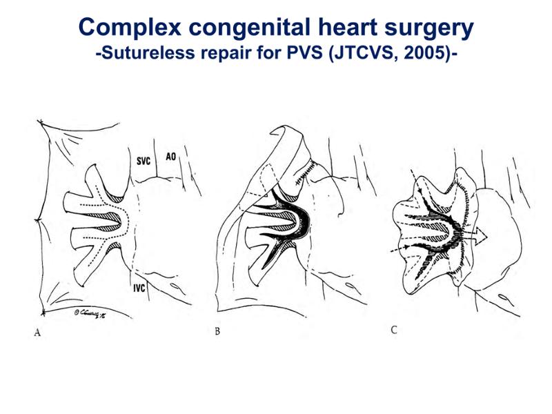 2025 Pediatric Heart Forum Presentation 252페이지