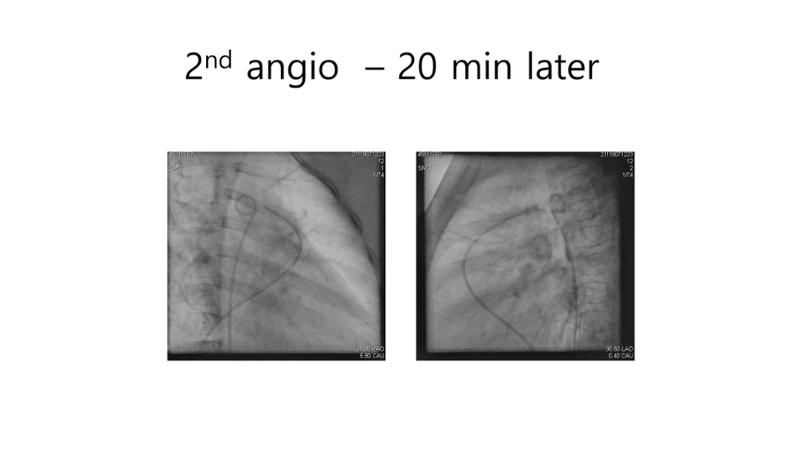 2025 Pediatric Heart Forum Presentation 32페이지