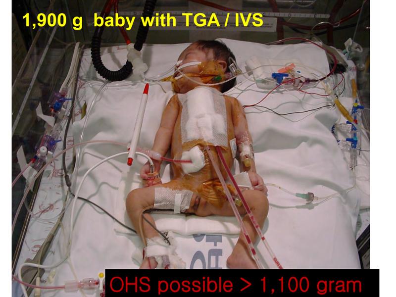2025 Pediatric Heart Forum Presentation 267페이지