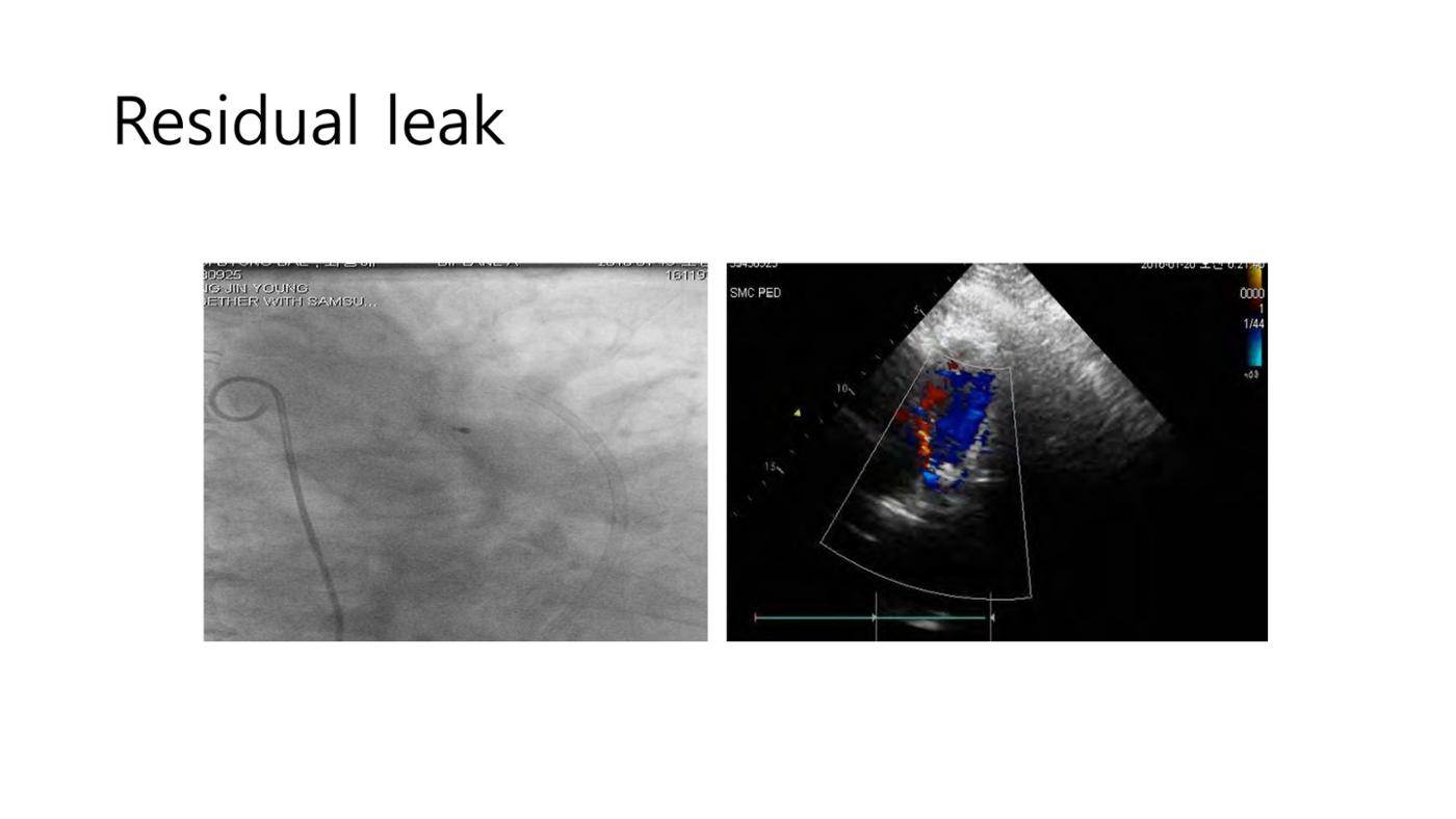 2025 Pediatric Heart Forum Presentation 42페이지