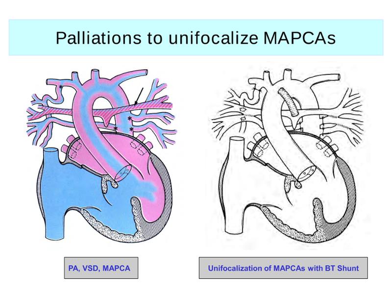 2025 Pediatric Heart Forum Presentation 287페이지