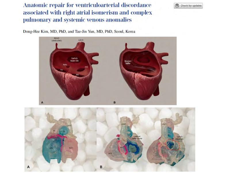 2025 Pediatric Heart Forum Presentation 263페이지