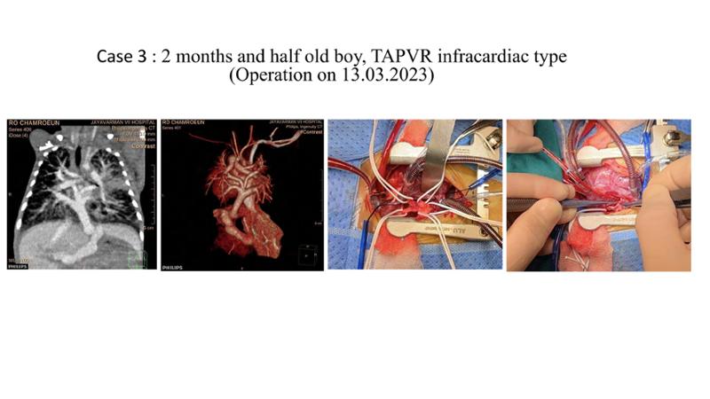 2025 Pediatric Heart Forum Presentation 376페이지