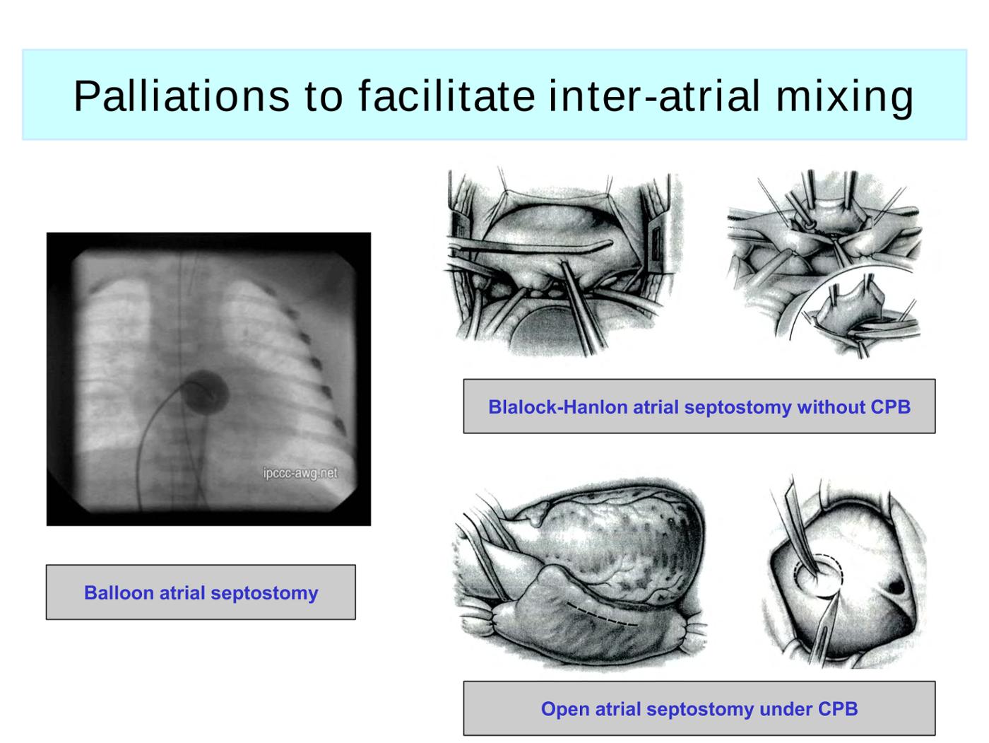 2025 Pediatric Heart Forum Presentation 288페이지