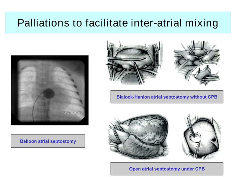 2025 Pediatric Heart Forum Presentation 288페이지
