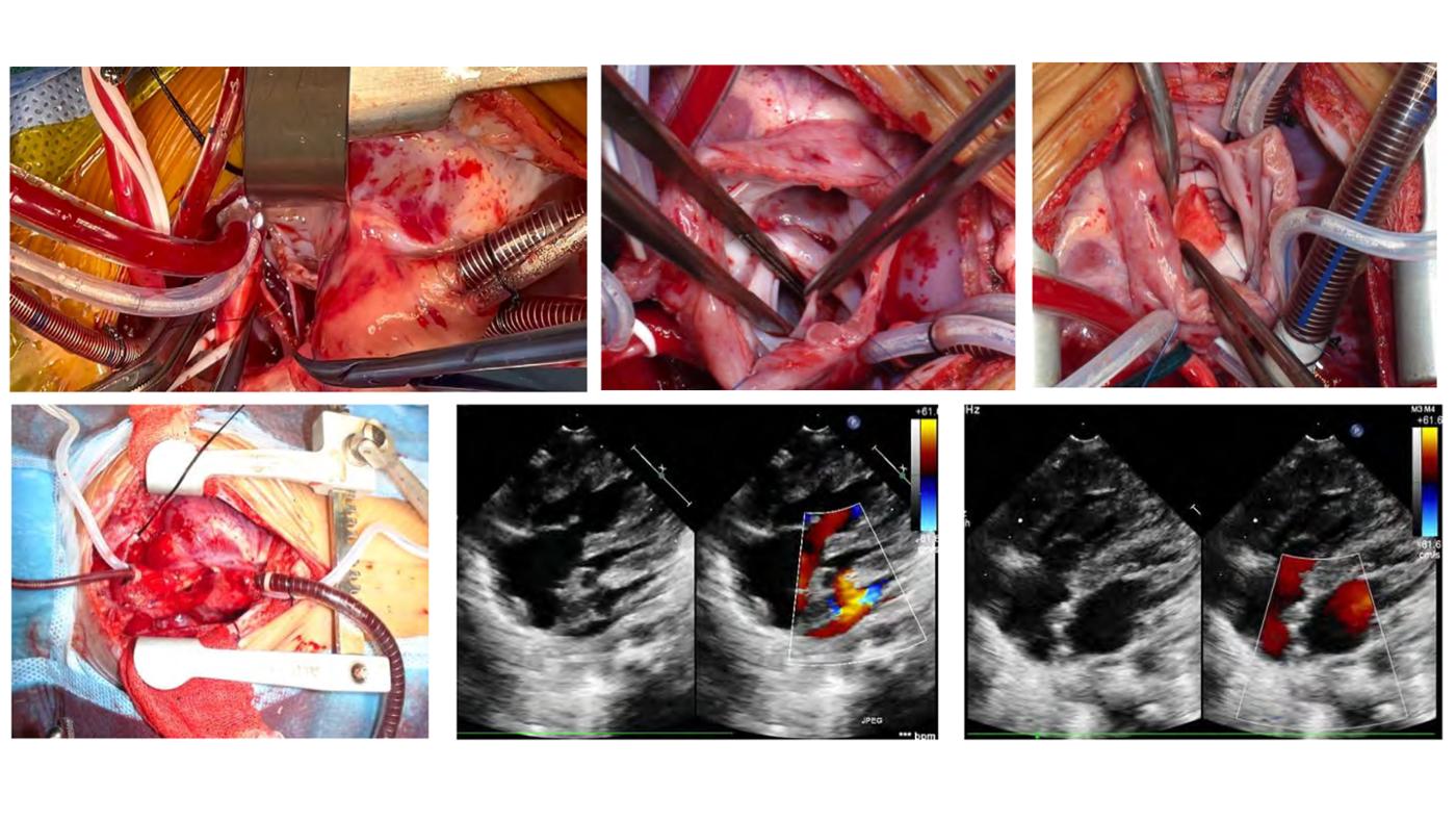 2025 Pediatric Heart Forum Presentation 375페이지