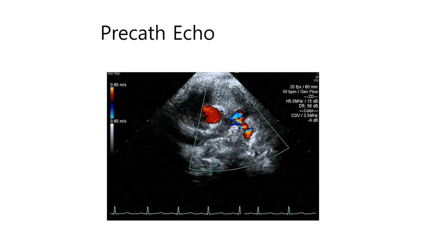 2025 Pediatric Heart Forum Presentation 29페이지