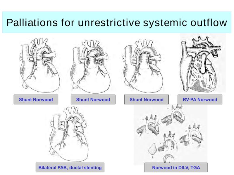 2025 Pediatric Heart Forum Presentation 290페이지